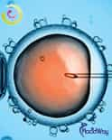 Fertility Treatments in Athens, Greece